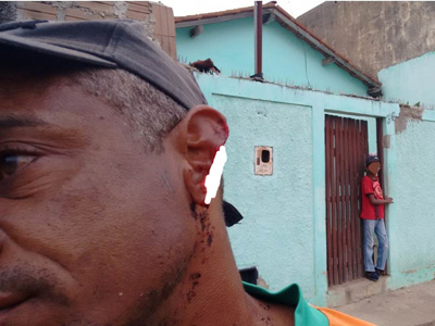 Conquista: mulher morde e arranca metade da orelha de ex-marido no Bairro Patagônia